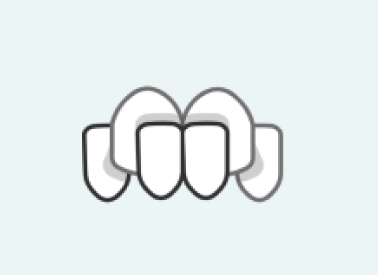 Crossbite