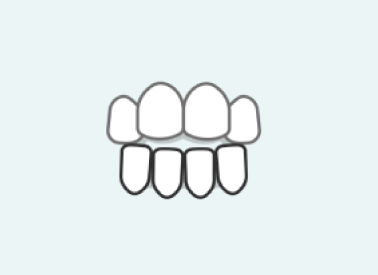 Gap Teeth